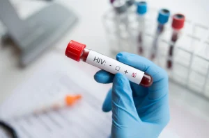 Hiv Pozitif